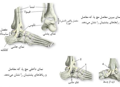 درد مچ پا
